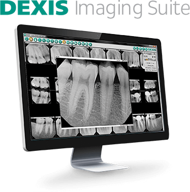 DEXIS Digital X Rays